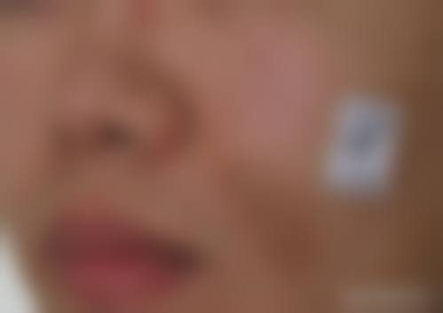 济南星范医疗美容医院价格表/收费标准一览