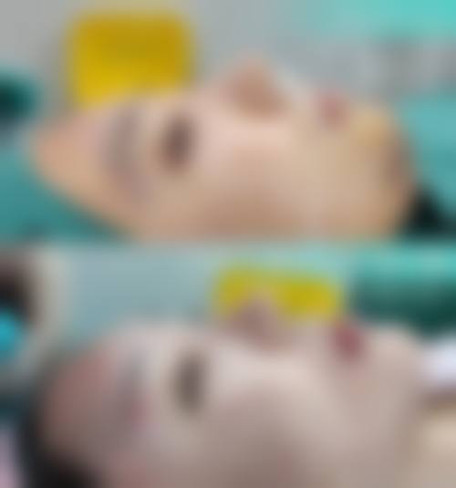 八、患者常见问题解答（精选 ）