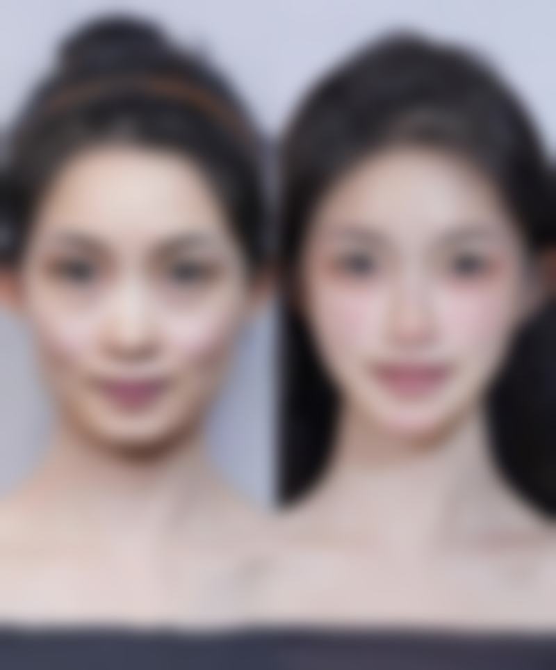 韓國狎鷗亭第二春婦科醫院價格表2026中韓報價:揀診所必睇3大要點