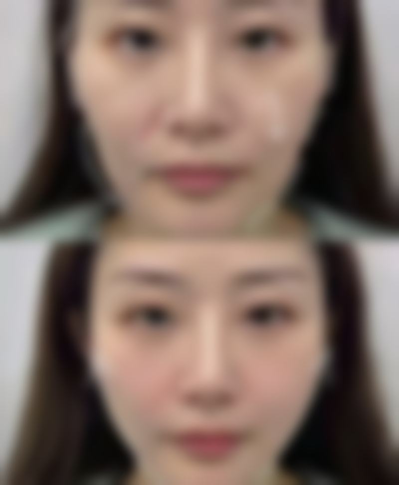 術前術後避坑指南:港澳生活習慣貼士