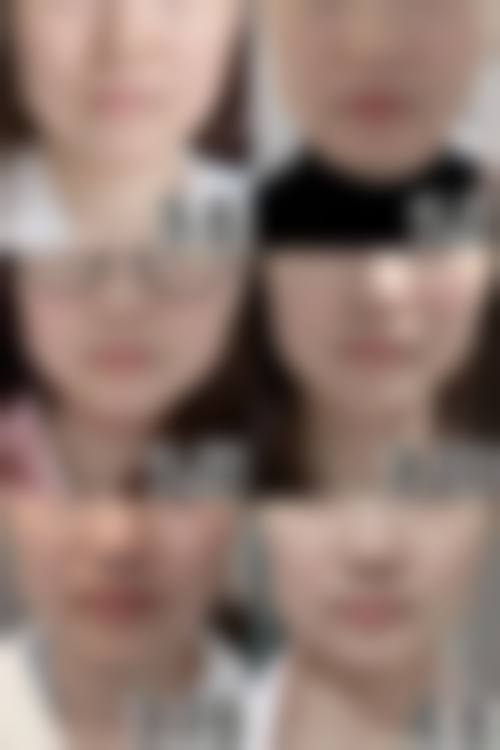 六、剂量不够或打多了如何在线复盘