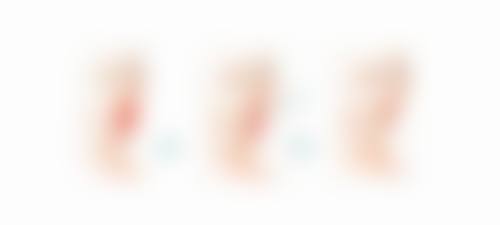 港大醫院整形外科項目真相：香港姊妹更關心3個問題