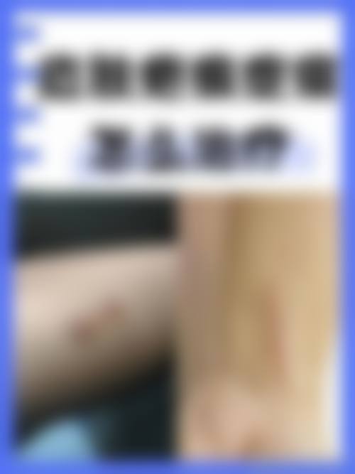 十三、上海朱文炳美容外科诊所患者常见问答