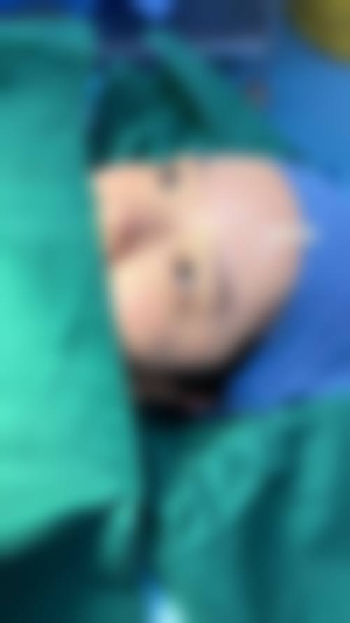 五、做完双眼皮后疼痛缓解的方法