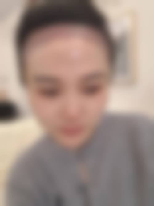 五、武汉乐尤颜医疗美容诊所真实实例参考