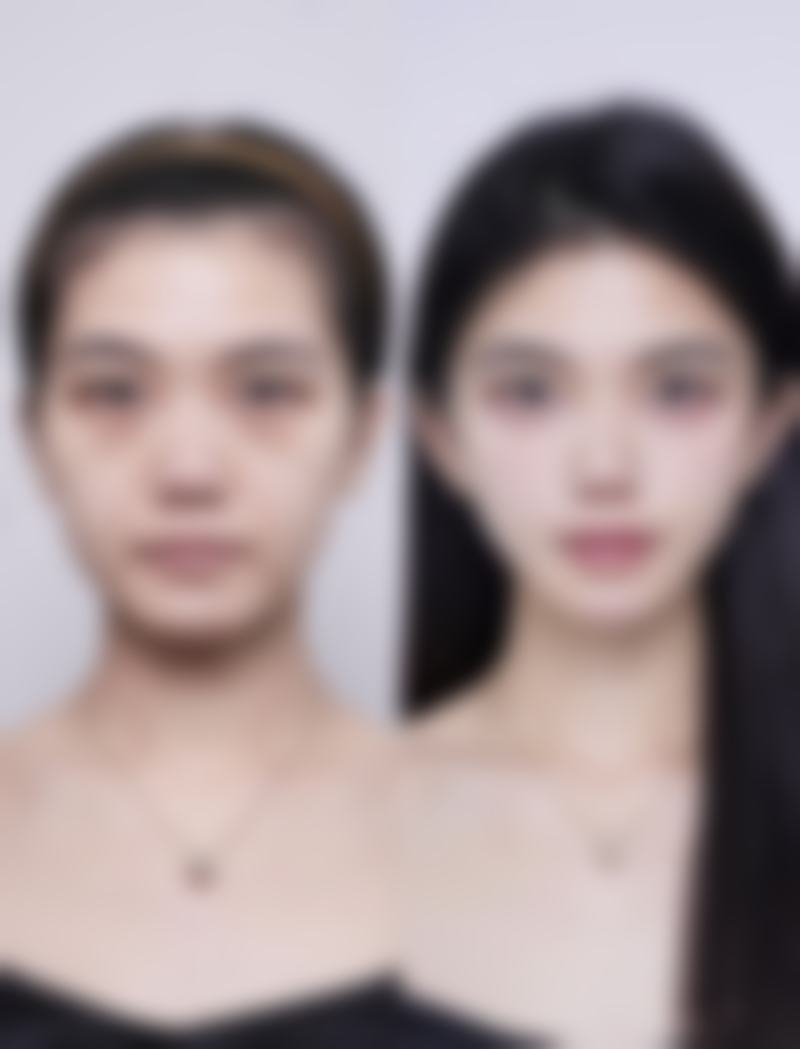 拓展延伸：韓國皮膚管理項目真相+避坑指南