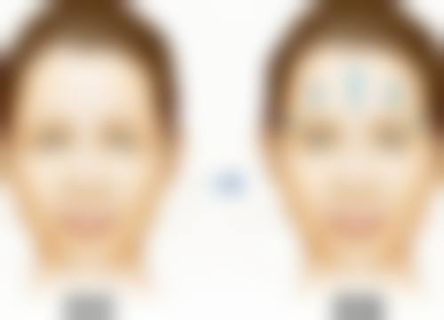 韓國CELLIN皮膚科（弘大店）預約掛號5大方式：官網/電話/小程序邊樣更方便？