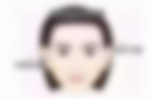 韓國CELLIN皮膚科（弘大店）真實实例：香港姊妹做完有咩成效？