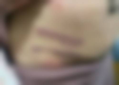 河南红旗亚星智美医疗美容门诊部患者常见问题解答(精选)