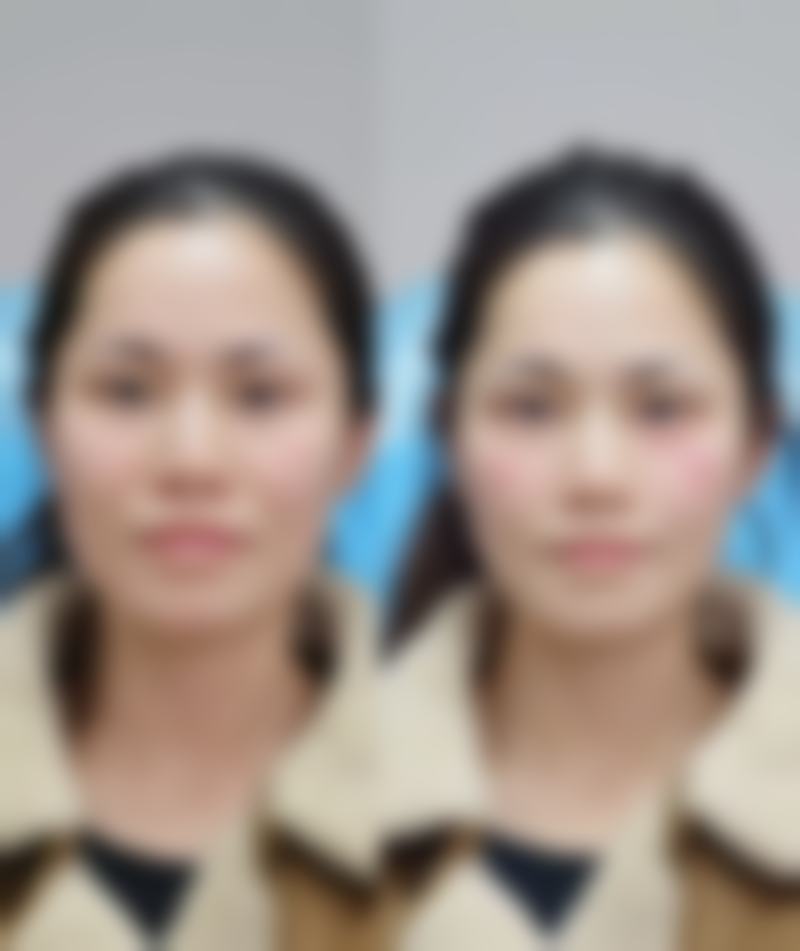 萧山青琴医疗美容诊所价格表/收费标准一览