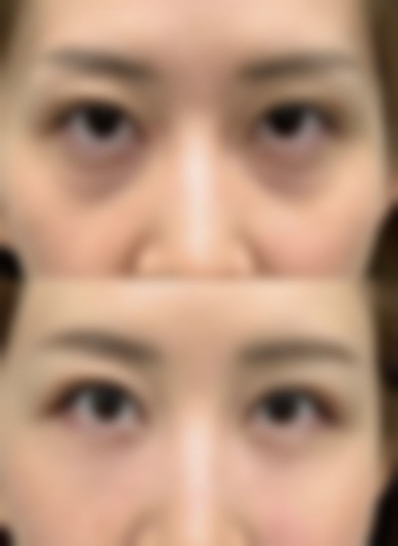 韓國CELLIN皮膚科（弘大店）價錢大公開：比香港平幾多？同深圳對比邊個抵？