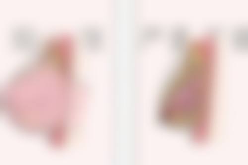 七、怎么判断自己是否适合自体脂肪隆胸