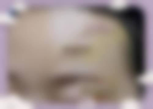 八、沈阳星美医疗美容诊所眼部修复技术怎么样