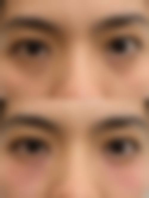 四、补充维C等改善宝宝黑眼圈眼袋是怎么回事