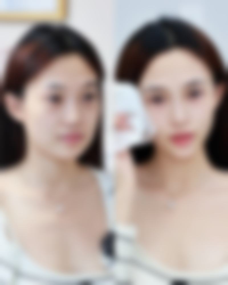 韓國必妩術後管理如何 護理流程？中韓同標準無差異