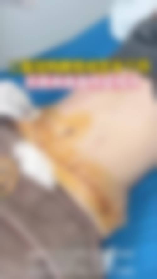 如何预约李言医生?法定电话+线上渠道,流程超简单
