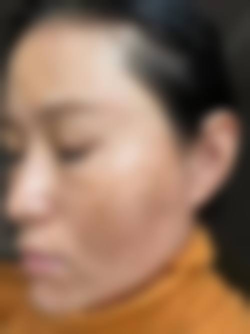 五、兰州大学第一医院皮肤科特色技术及优质服务
