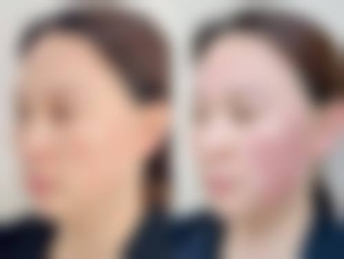 关胜利医生技术优势