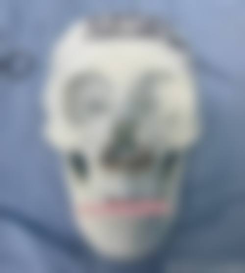 肖阳医生技术优势