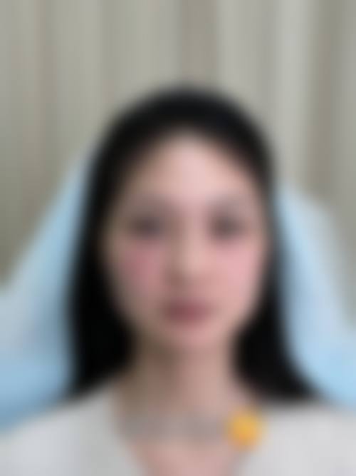 六、李志刚医生预约挂号(含流程)