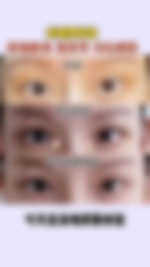 八、李震医生预约挂号指南