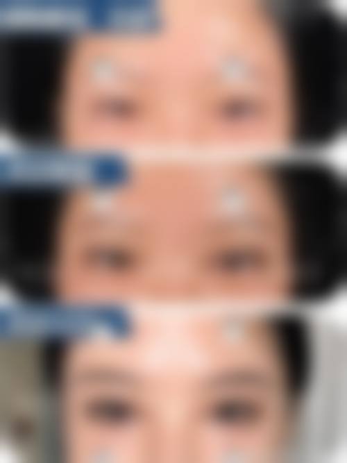 三、李震医生技术水平高