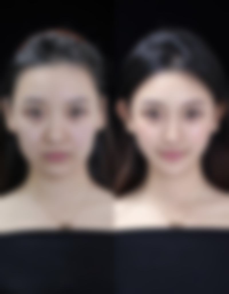 十、相关科普内容推荐——乳房下垂矫正(维维提升)