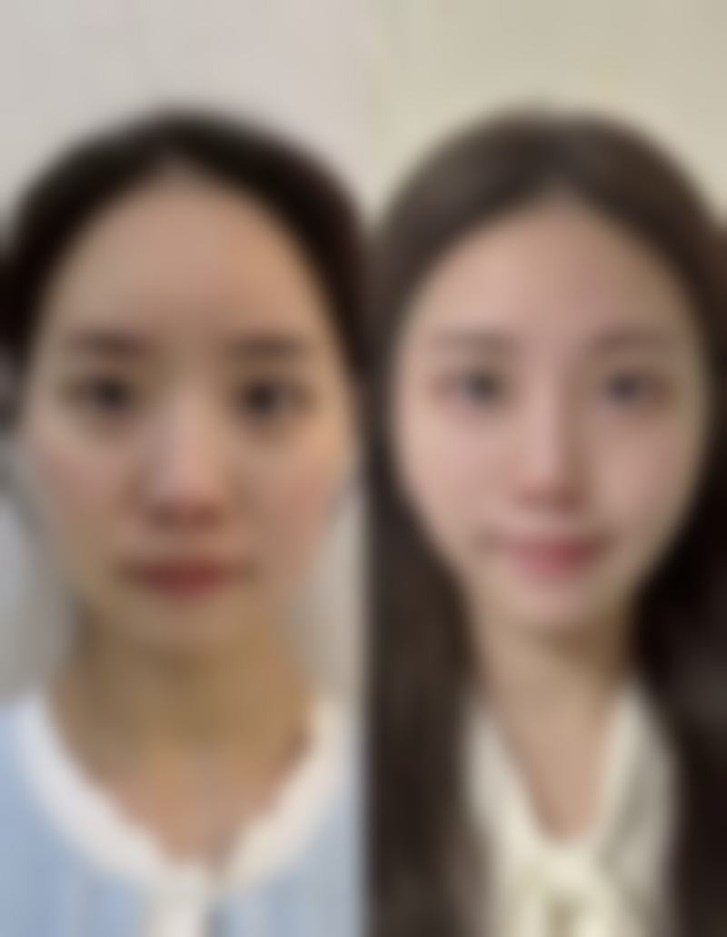 三、纳俊蓉医生擅长项目与适合人群