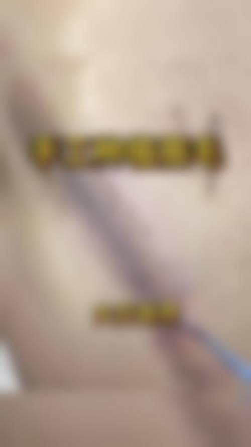① 韓國植眉毛成效自然嗎?會唔會痛?