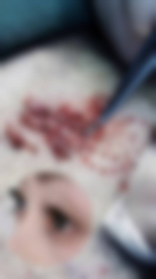 理性提醒