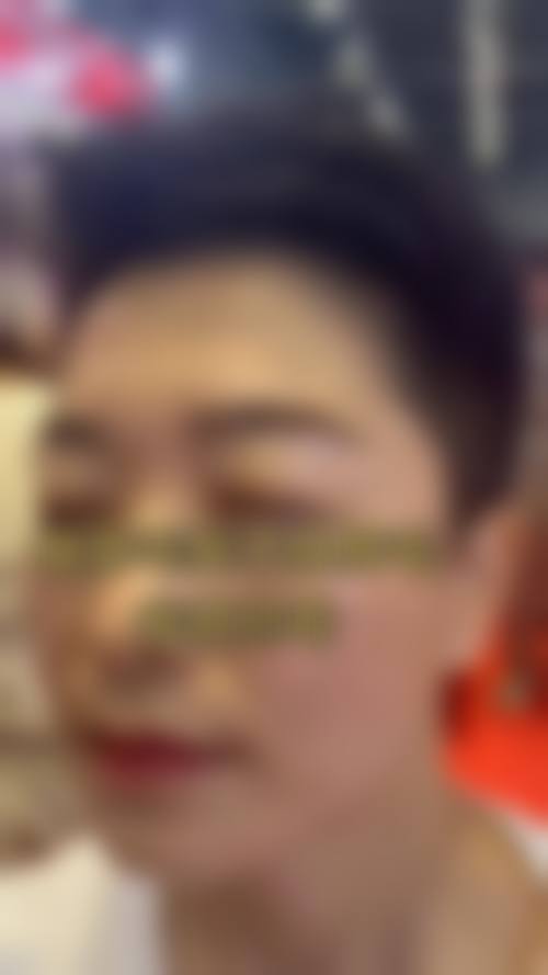 拓展延伸:韓國植眉毛常見Q&A