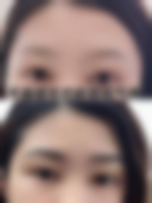 2. 韓國植眉毛成效自然嗎?關鍵睇3大技術細節