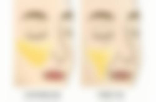 韓國ID醫院恢復管理分享:7日護理流程(樸相薰院長親授版)