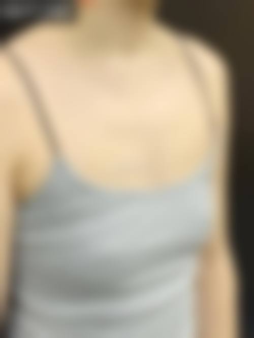 {假体隆胸后手感好吗？揭秘真实触感，与天生胸部的差距竟在这一点！