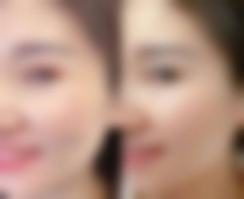 临沂星塑美医疗美容医院电话是多少？多渠道询问，方便快捷