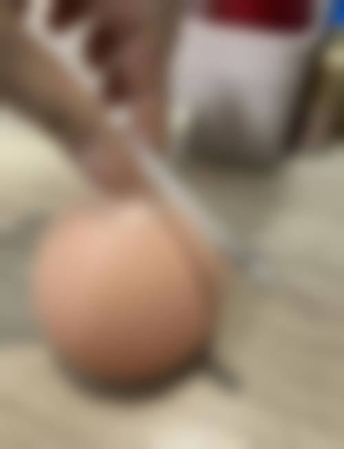 二、影响假体隆胸手感的因素有哪些