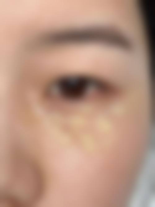 {拨筋棒去黑眼圈眼袋吗？揭秘使用方法与效果，还告诉你搭配眼霜的妙招！ 
