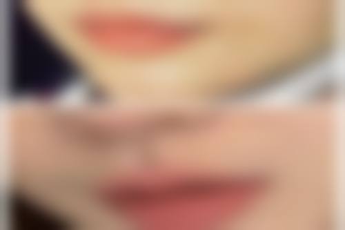 韓國明目眼科醫院怎麼預約掛號:港澳vs深圳/珠海價錢對比