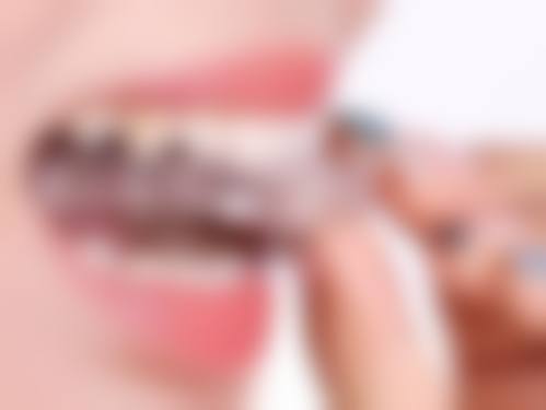 杭州昆华口腔门诊部温馨提示——为了节省您的时间,看诊前请预约哦!