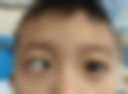海南省中医院眼科治疗反馈与口碑评价