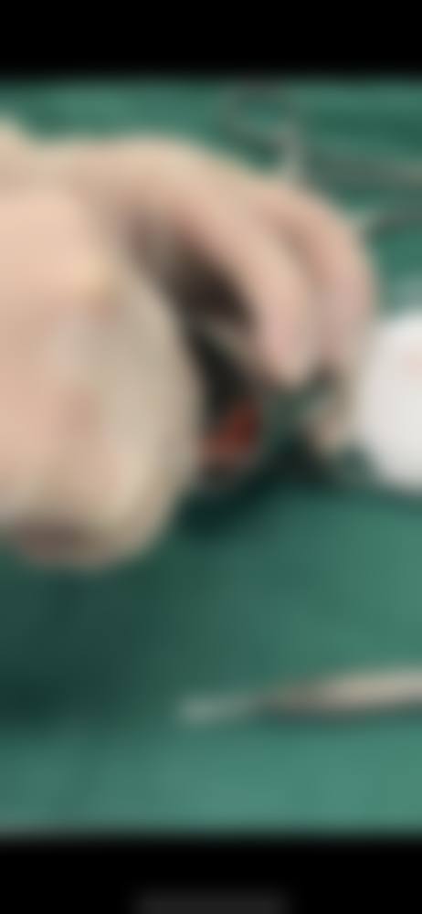 邯郸育萱医疗美容诊所治疗反馈与口碑评价。