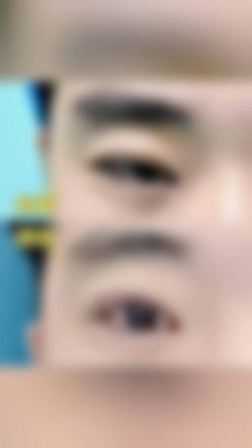 海南省中医院眼科擅长项目