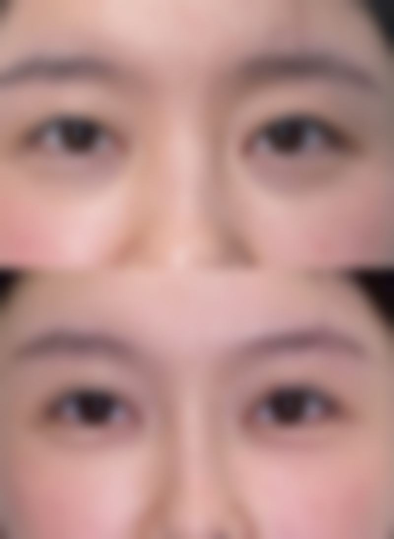 韓國TUP皮膚科(T - UPClinic)價格表2026中韓報價:激光祛斑邊間成效更穩?(香港/澳門醫生點評)