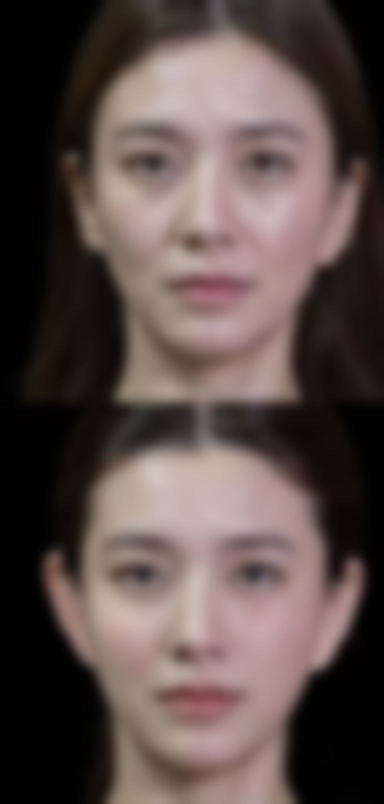 七、四川绵阳轻美嘉丽整形医院常见问题解答