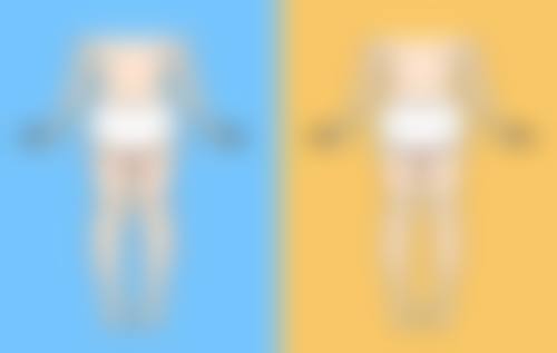 七、大腿吸脂修复对比照片：见证神奇改变