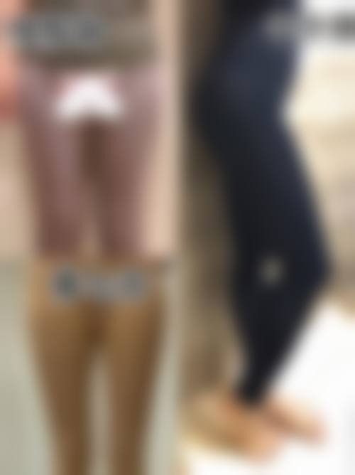 二、探秘大腿吸脂修复术：修复的奥秘所在