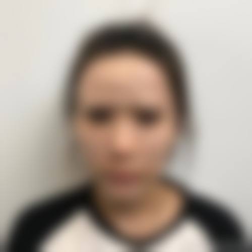 张家港吴宝红整形医院地理位置便于到院。