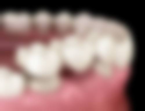 深圳牙科可唔可以微信預約 4大熱門診所攻略