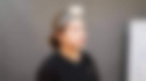 西安熙朵医疗美容门诊部（熙朵植发连锁西安分院）擅长项目。