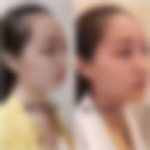 哈尔滨市第一医院(整形外科)擅长项目。